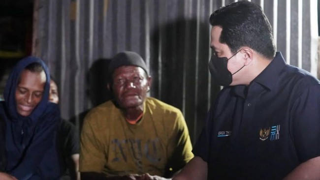 Menteri BUMN, Erick Thohir menjamin pengobatan mantan pebasket putri nasional asal Papua, Jacklien Ibo agar pulih dari penyakit radang paru-paru.