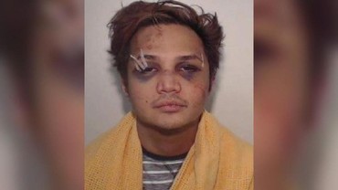 Heboh! Beredar Foto Reynhard Sinaga si Predator Seks Babak Belur