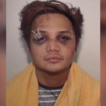 Babak Belur, Kondisi Reynhard Sinaga Usai Diserang Sesama Napi