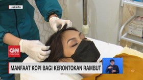 VIDEO: Manfaat Kopi untuk Cegah Kerontokan Rambut
