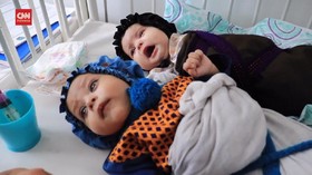 VIDEO: Dua Juta Anak Afghanistan Terancam Kekurangan Gizi