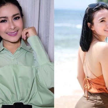 Cantik & Menggoda, Simak Potret Artis Indonesia yang Punya Kumis Tipis