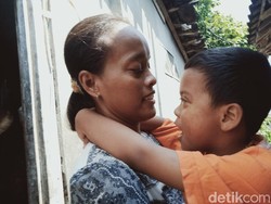 Pilu Ibu di Klaten, Anaknya Mendadak Buta-Suami Pergi Tak Tahu Rimbanya