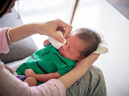 Mata Bayi Baru Lahir Belekan, Perlukah Diberikan Salep?