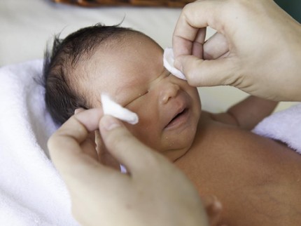 Bolehkah Mata Bayi Belekan Ditetesi ASI? Simak Penjelasan Pakar Laktasi