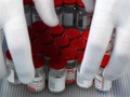 Afrika Selatan Tolak Vaksin Covid Sputnik V Gegara Risiko HIV