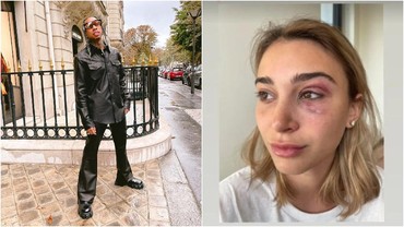 img-title Mantan Pacar Ungkap Foto Babak Belur, Tyga Resmi Ditangkap Polisi