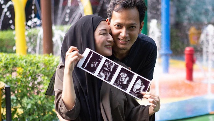 Fedi Nuril dan istri Fedi Nuril dan istri