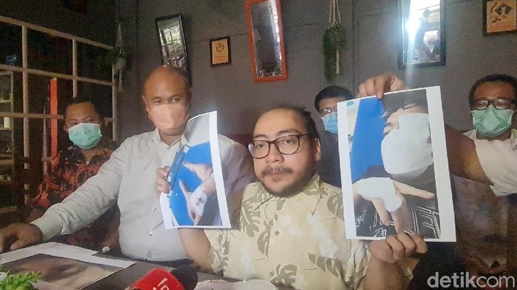 Mueng Engingeng Mueng Engingeng dianiaya tetangga