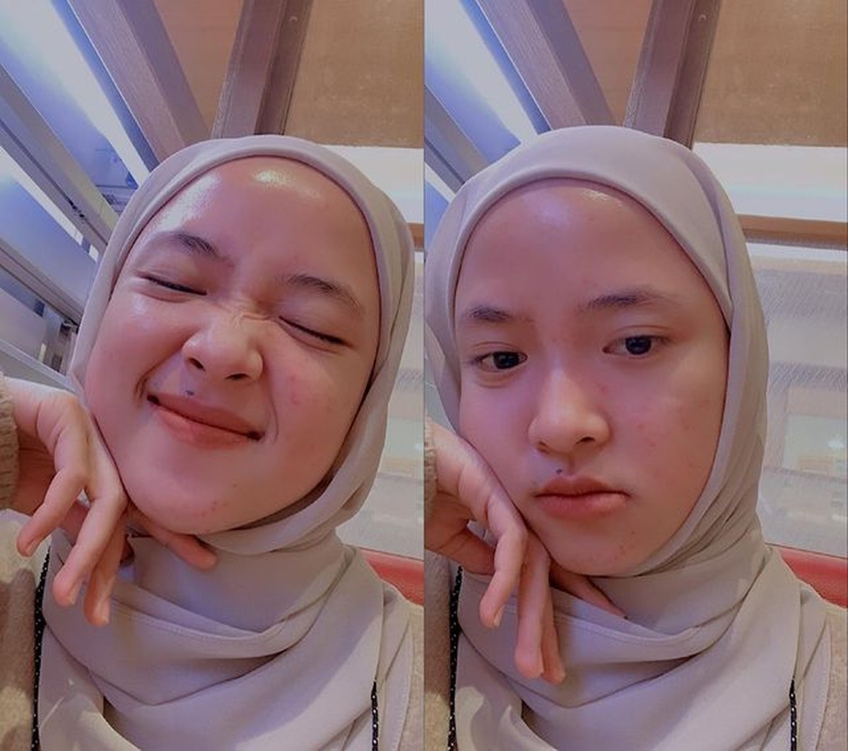 Nissa Sabyan sempat mengalami jerawatan parah di wajahnya&comma; kini ia pamer wajah mulus yang tuai pujian&period; Yuk intip&excl;