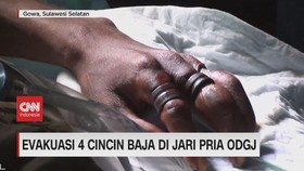 VIDEO: Evakuasi 4 Cincin Baja di Jari Pria ODGJ