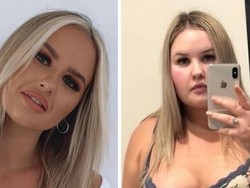 Dulu Makan Junk Food Tiap Hari, Wanita Ini Berhasil Turunkan BB 30 Kg