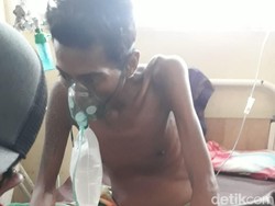 Tolong! Pria di Dompu NTB Alami Tumor Ganas di Perut Hidup Sebatang Kara