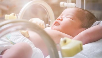 DAMPAK MELAHIRKAN CAESAR PADA MIKROBIOTA ANAK
