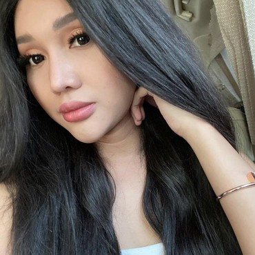 Lucinta Luna Pamer Wajah Baru Oplas, Ini Komentar Nyeleneh Boy William