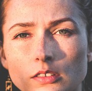 Mulai Muncul Kerutan dan Flek Hitam? Jangan Tunggu Usia 40an untuk Mengatasinya