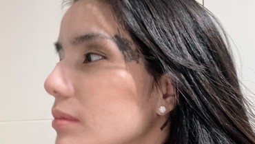 Sheila Marcia Pamer Mata Lebam Kena Tampol, Siapa Pelakunya?