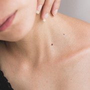 3 Pilihan Komposisi untuk Mencerahkan Kulit, Mana yang Paling Cocok untukmu?