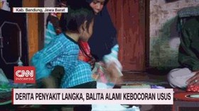 VIDEO: Derita Penyakit Langka, Balita Alami Kebocoran Usus