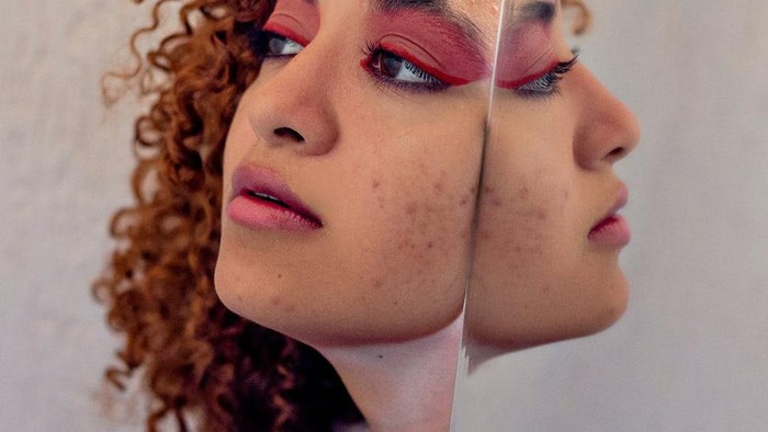 BeauPicks: 3 Acne Patch Lucu yang Bikin Kamu Tetap Gemas Meski Berjerawat