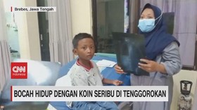 VIDEO: Bocah Hidup dengan Koin Seribu di Tenggorokan