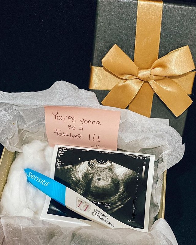 Regina Ivanova memberikan kejutan kepada sang suami tentang kehamilannya, ekspresi Lucky Jayadi pun disorot. Yuk intip!