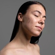 5 Kandungan pada Skincare yang Perlu Diwaspadai Penggunaannya Menurut Ahli Dermatologi