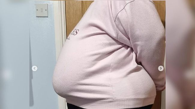 Perempuan asal Seghill, Laura Howes mencurahkan kegundahannya memiliki ukuran payudara fantastis yakni 36P.