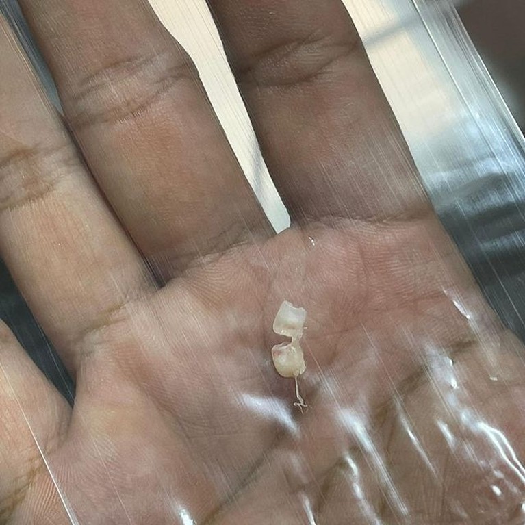 7 Foto Baby Mecca Anak Arief Muhammad yang Baru Lahir Punya Dua Gigi Arief Muhammad dan Tiara Pangestika tengah berbahagia atas kelahiran anak kedua mereka. Yuk intip foto baby Mecca yang punya dua gigi!