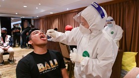 Cara Kerja SGTF Deteksi Varian Omicron Kala Sulit Pakai PCR di RI