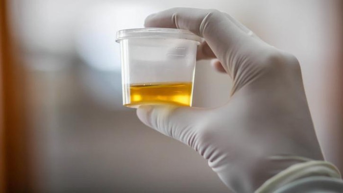 Wanita Ini Kecanduan Minum Air Urinenya Sendiri Agar Panjang Umur