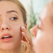 BeauPicks: Skincare untuk Jaga Kelembaban di Musim Hujan, Anti Kulit Kering!