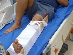 Aksi Kejar Bandar Narkoba Berujung Polisi Dilindas hingga Patah Kaki