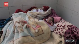 VIDEO: Krisis Pangan Afganistan, Banyak Bayi Kekurangan Gizi