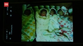 VIDEO: Kelahiran Bayi Kembar 4 Di Bandung Barat. 2 Bayi Meninggal