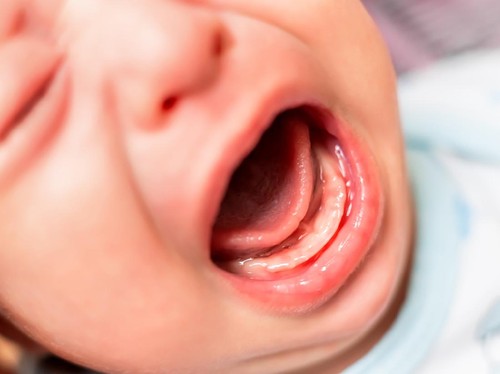 Balita Luka Diduga Digigit di Daycare, Orang Tua Lapor Polisi
