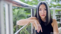 Cerita Model Zsazsa Caesar Idap Vitiligo, Dibully & Disebut Anak Hasil Pesugihan