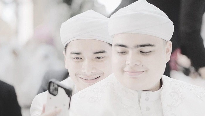 Ameer Azzikra, Adik Alvin Faiz Meninggal Dunia Akibat Infeksi Liver