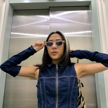 ZsaZsa Caesar Jadikan Kondisi Vitiligo Sebagai Keunikan hingga Jadi Model