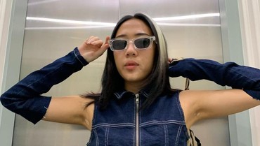 ZsaZsa Caesar Jadikan Kondisi Vitiligo Sebagai Keunikan hingga Jadi Model