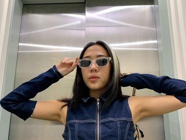 ZsaZsa Caesar Jadikan Kondisi Vitiligo Sebagai Keunikan hingga Jadi Model