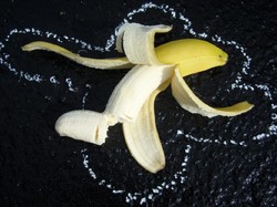Ngilu! Penis Patah Saat Bercinta hingga 21 Hari Tak Bisa Pipis Normal