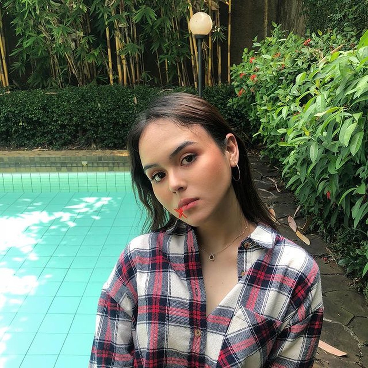 Laura Anna tuntut mantan kekasihnya Gaga Muhammad usai kecelakaan 2 tahun lalu yang menyebabkan ia lumpuh total&period; Yuk intip potretnya&excl;