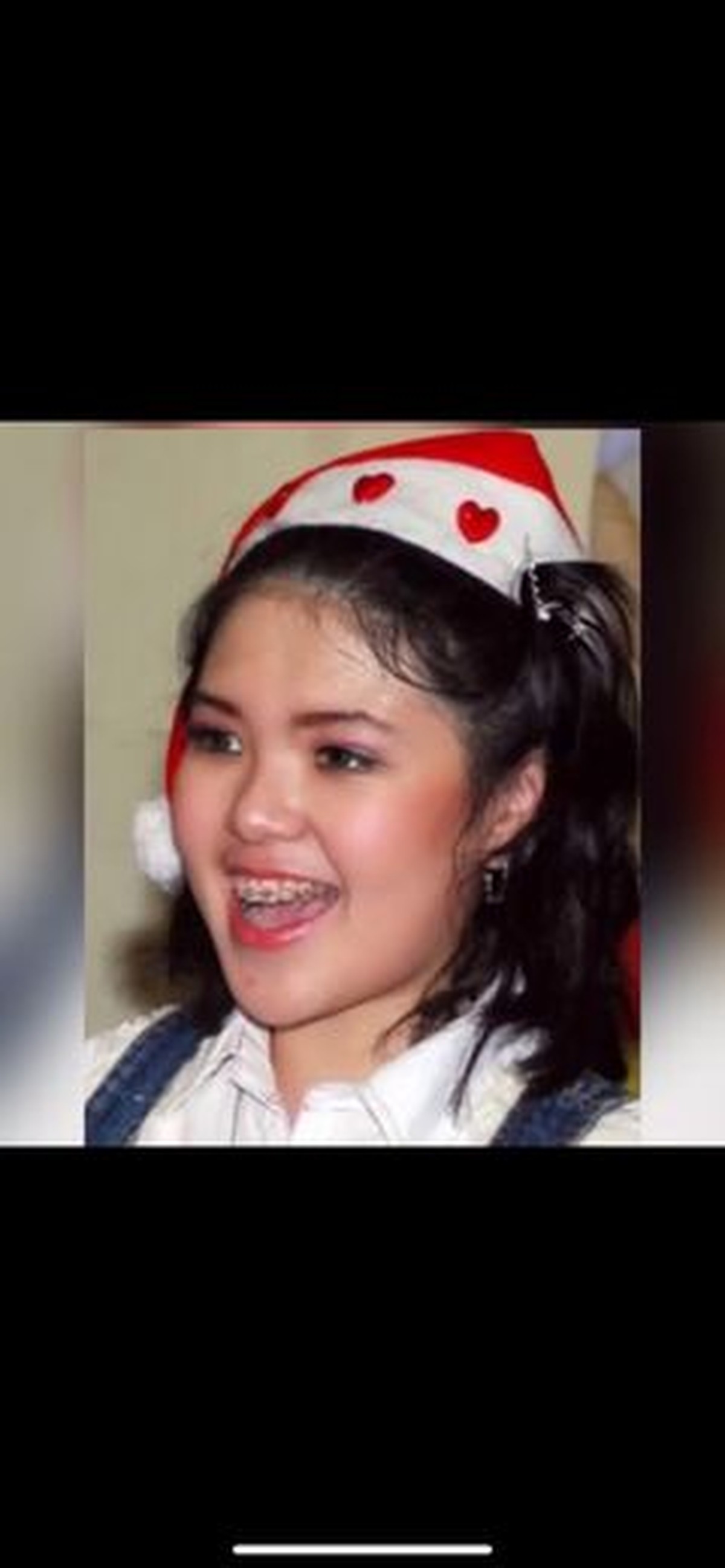 7 Transformasi Tina Toon dari Pipi Chubby hingga Tirus Disebut Oplas