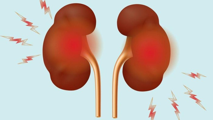 Cek! 6 Tanda Ginjal Kamu Nggak Sehat: Mulai dari Kulit Kering Gatal hingga Otot Sering Kram Cek! 6 Tanda Ginjal Kamu Nggak Sehat: Mulai dari Kulit Kering Gatal hingga Otot Sering Kram
