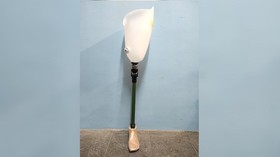 Pasien Amputasi Menanti Kaki Palsu, Mari Donasi Lewat Berbuatbaik.id