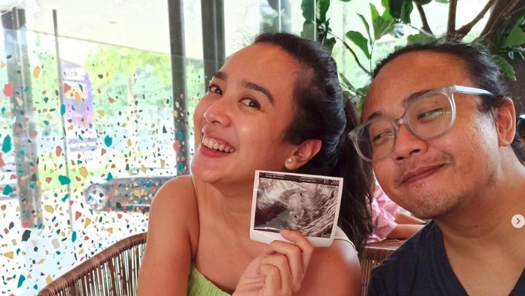 Dea Ananda hamil anak pertama.