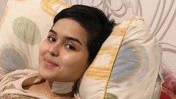 Ini Penyebab dan Arti Ulkus Dekubitus yang Diidap Laura Anna