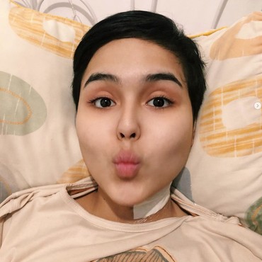 Kakak Ungkap Fakta Rambut Bondol Laura Anna Ulah Ibunda Gaga Muhammad