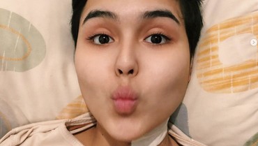 img-title Kakak Ungkap Fakta Rambut Bondol Laura Anna Ulah Ibunda Gaga Muhammad